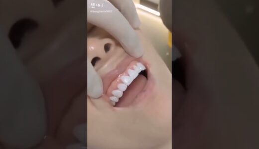 歯を掃除する歯科医 ::: 歯のホワイトニング ::: 歯のクリーニング歯石の除去
