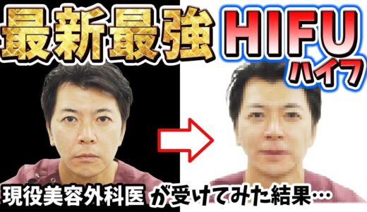 【たるみ治療】50代男性が医療HIFU（ハイフ）を受けたら変化が凄すぎた