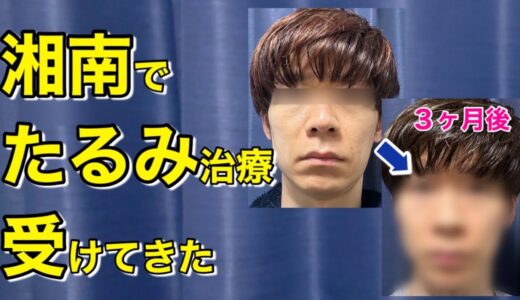 医療ハイフ　やってよかったとしか思えない結果になりました【3か月後の効果をお伝えします】