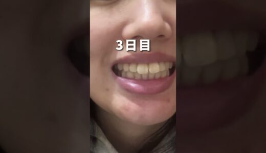 【検証】予防もできるホワイトニング！2週間チャレンジ #shorts #ホワイトニング #検証