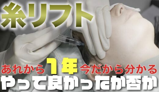 【糸リフト】あれから1年。ぶっちゃけどうなの！？月日が経ったから分かること。