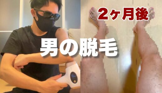 【検証】家庭用脱毛器を使用した結果【メンズ脱毛】