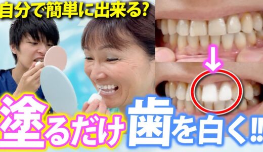 【超簡単】自宅でたったの10秒で確実に歯を真っ白にする方法【セルフホワイトニング 歯科医が検証】