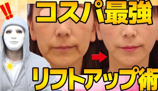 【ほうれい線消す方法】進行してしまうシワは10分で改善できる糸リフト【コスパ最高　湘南美容の医師が解説】