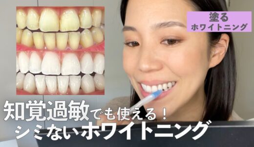 【最新版ホワイトニング】シミない！痛くない！知覚過敏でも使えるホワイトニング方法をご紹介します