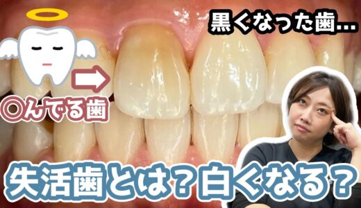 【あなたは大丈夫？】ぶつけて黒くなった歯…失活してるかも？ホワイトニングで白くする事はできるの？