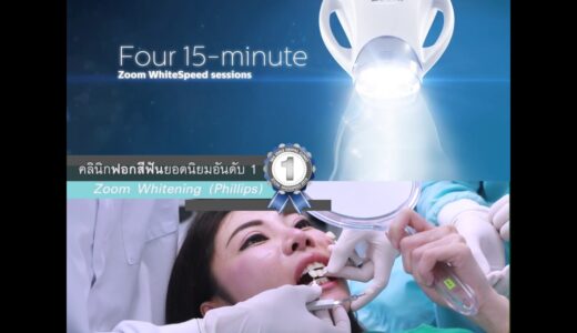 ４５分内で歯を白くする、バンコクスマイルのホワイトニング (Zoom Teeth Whitening)