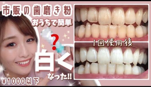 【驚愕‼︎】1回の歯磨きで歯が白く！ステイン着色汚れが気になる人必見！お家でお手軽【ホームホワイトニングケア】