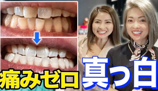 【プロモーションあり】痛くない！コスパ良し！バンコクにあるホワイトニングのお店を調査！