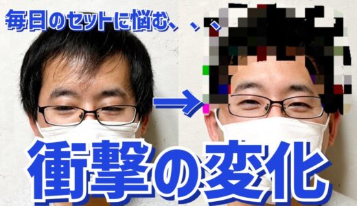 【薄毛】M字・つむじの透け感を改善！清潔感のある髪型に