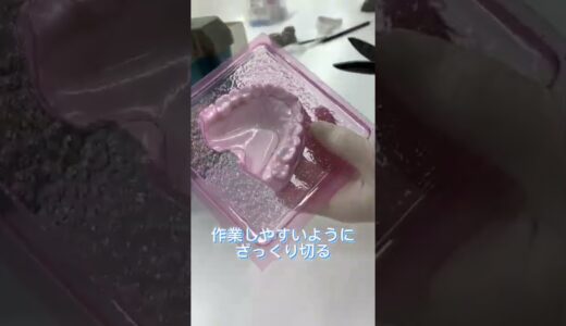 【ホワイトニング用マウスピースができるまで】