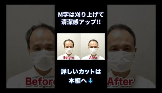 【薄毛】M字ハゲを刈り上げて清潔感アップ!