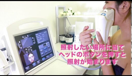 最新4Dハイフ　顔用　使用方法動画