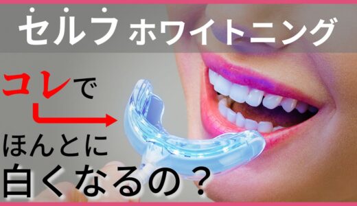 セルフホワイトニングで白くなるのか？歯医者のホワイトニング違いをプロが解説します！