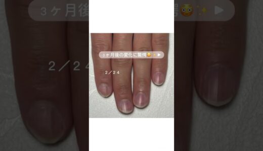 男性のお客様の3ヶ月間の変化💅🏻✨️ #ネイリスト #自宅ネイルサロン #ネイル #自宅サロン #自宅サロン開業 #美爪 #育成