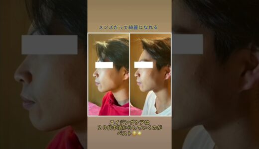 メンズハイフ☆エイジングケアは２０代中頃から(^^)