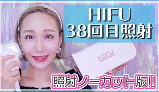 【HIFU ハイフ】38回目照射!!!初の照射ノーカットでお見せします💜【リフトアップ】【家庭用ハイフ】