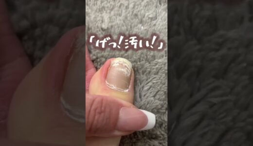 げっ！足の爪が汚い！という印象に？！ #nails #nailsalon #ネイル #ネイルサロン