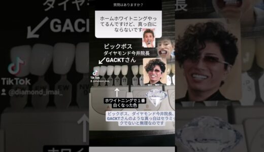 ホワイトニングの１番白い色は？大阪前歯セラミック矯正専門ダイヤモンド今井院長#セラミック#ホワイトニング#ダイヤモンド今井院長