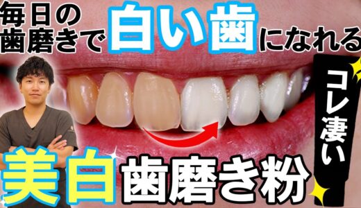 【歯を白くする方法】歯医者が本気で選んだ美白歯磨き粉TOP3！