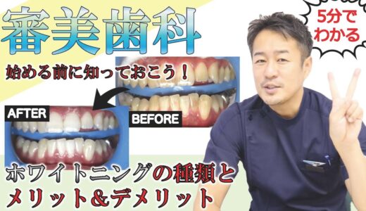 歯が白くて綺麗ですね！でも…そのホワイトニングって本当に大丈夫？