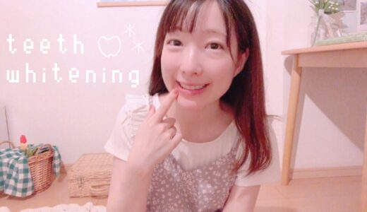 歯のホワイトニングしてきた🤍✨ teeth whitening