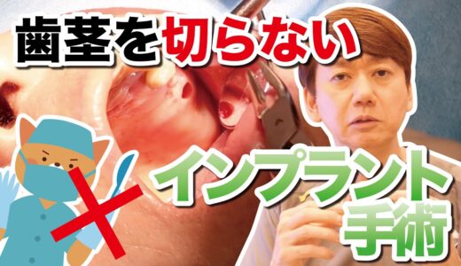 【切開なし！縫合なし！】楽・早い・痛くない・歯茎を切らないインプラント！