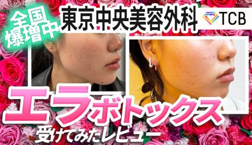 【エラボトックスレビュー】噂の美容整形 東京中央美容外科の雰囲気やカウンセリングなど是非ご参考に