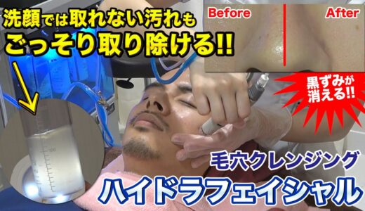 【毛穴クレンジング】メンズにも大人気！気になる毛穴の大掃除『ハイドラフェイシャル』を体験