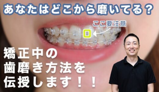 【矯正中の】あなたはどこから磨いてますか？【正しい歯磨き方法】