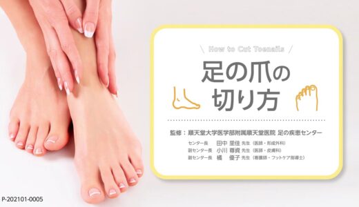 「巻き爪予防に効果あり！　正しい爪の切り方」（順天堂大学医学部附属順天堂医院　足の疾患センター）