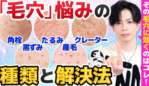 【あなたの毛穴悩みはどのタイプ？】毛穴悩みの種類と解決法！効くスキンケア＆美容医療を解説！【角栓・黒ずみ・たるみ・クレーター・産毛】