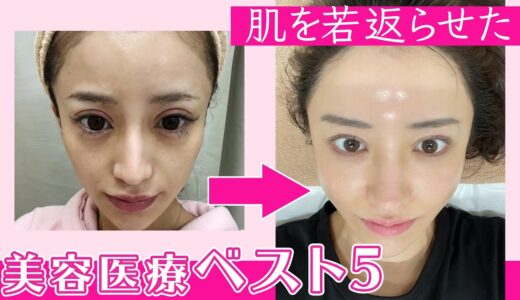 【美肌治療】ボロボロだったお肌を若返らせた方法