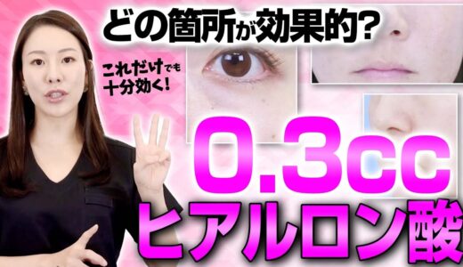 ヒアルロン酸０.３ccをどこに使えば若返るかを解説します。