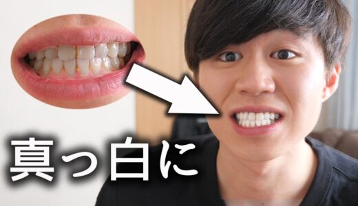 【超簡単】歯を白くする方法