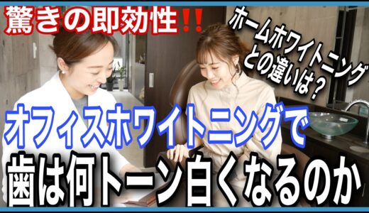 【ホワイトニング】驚きの即効性！オフィスホワイトニングで歯を白くして来ました！