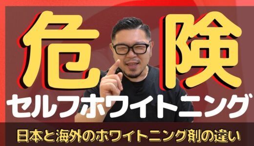 【セルフホワイトニング】安くて簡単！だけど…実際のところどうなの!?