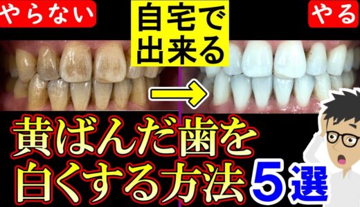 自宅で簡単に歯を白くする方法5選！黄ばんだ歯を白くする【歯周病｜歯磨き粉｜歯石｜ホワイトニング｜ステイン】