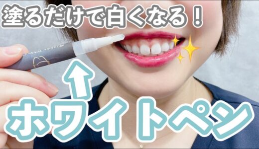 【塗るだけで白くなる！】ホワイトペンという新しいホームホワイトニングをご紹介✨