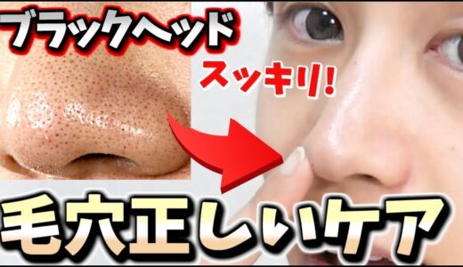 【美鼻】ブラックヘッドの治し方!! 本気で黒ずみ毛穴治したい人へ。  You can remove blackheads!