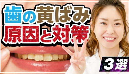 歯が黄ばむ原因と対策！ステイン除去して歯を白くする方法