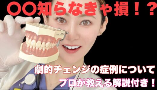 知らないと損する⁉綺麗な仮歯を歯科️技工士が解説‼️