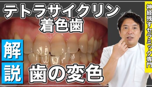 「歯が黒い」ことで長年お悩みの方へ…【テトラサイクリンとは…？】