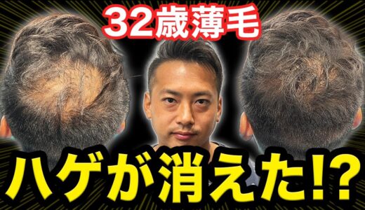 【30代薄毛】薄毛が目立たないヘアセットで大変身！