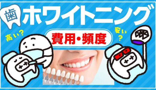 歯のホワイトニングの費用や頻度を種類別で解説｜ホワイトニングちゃんねる