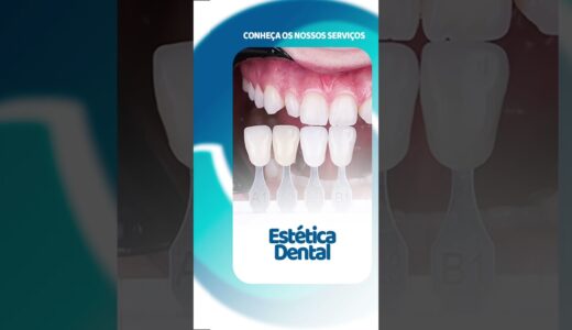 NOSSOS SERVICOS (Odonto Sano – Clínica Dentária )