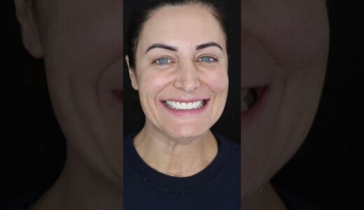 Invisalign and whitening smile makeover #cosmeticdentistry #dentist #invisalign #teethwhitening