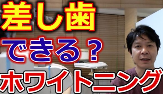 差し歯でもホワイトニングできるのか？【千葉市中央区の歯医者】