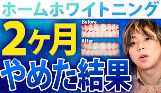 【2か月経過】ホームホワイトニングやめたらどのくらい歯の色戻りする？【オパールエッセンス】_Vol36