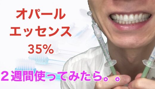 【ホワイトニング】オパールエッセンス35％　2週間使ってみたら、、